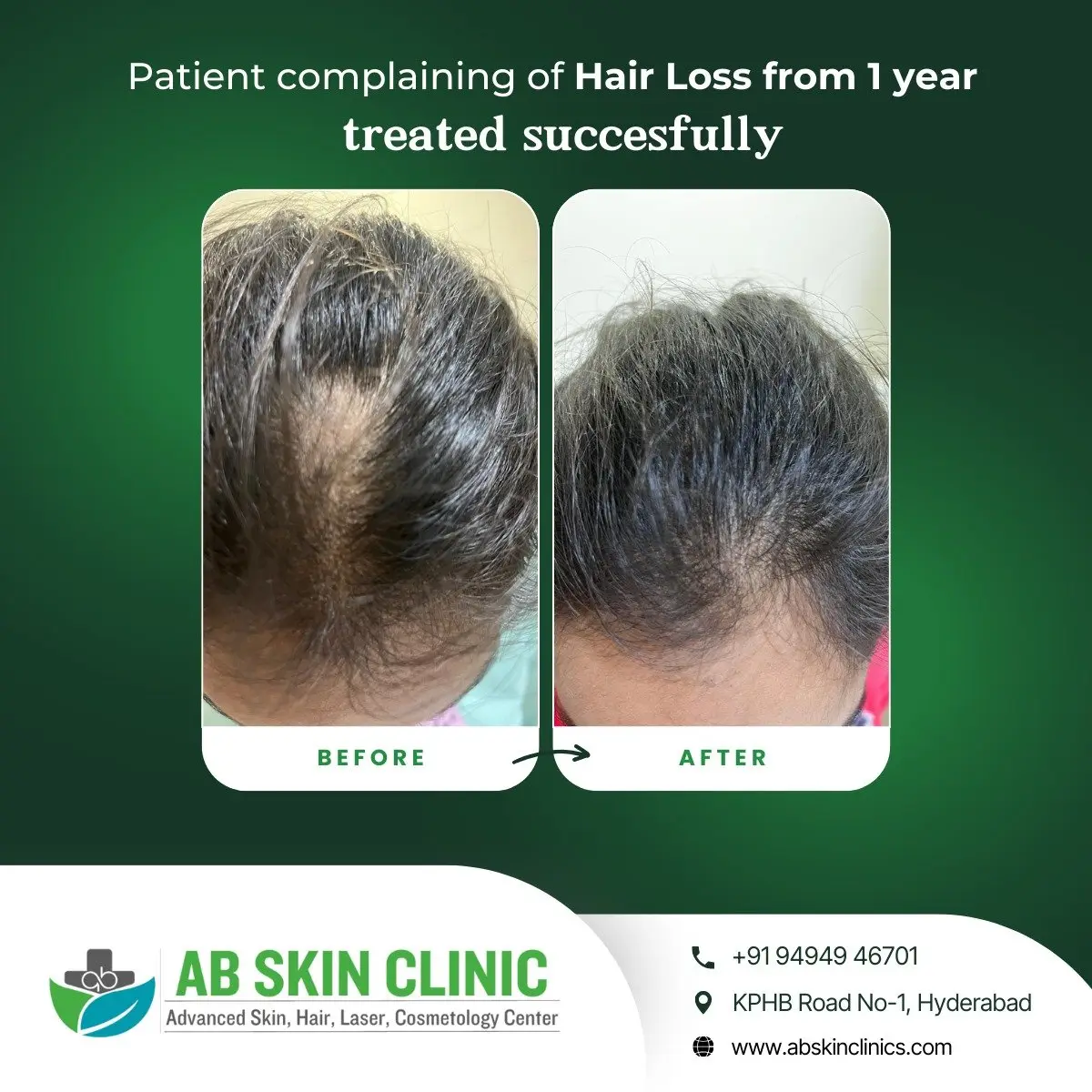 Clinic photograph published with the caption hair loss treatment.