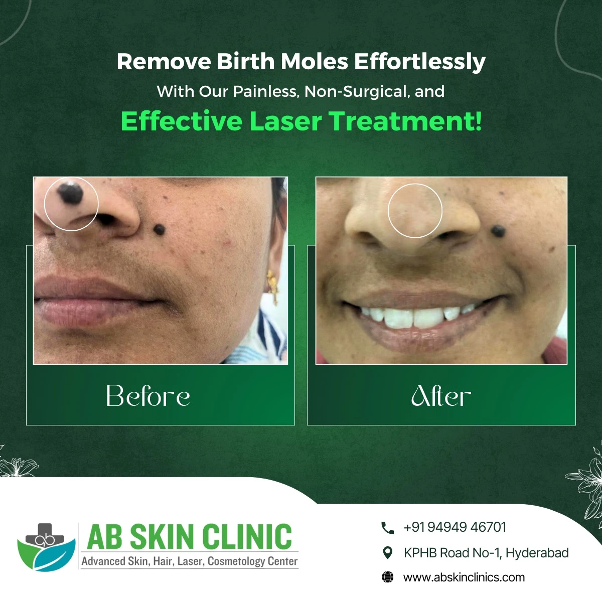 Clinic photograph published with the caption effective laser treatment.