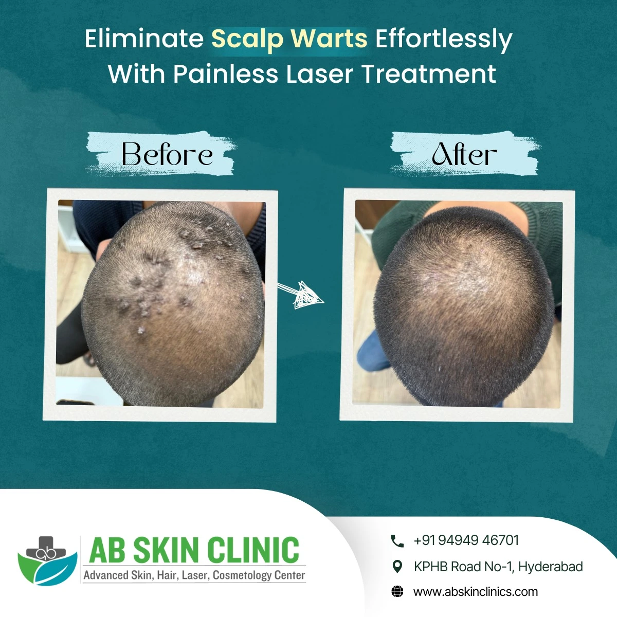 Clinic photograph published with the caption painless laser treatment.