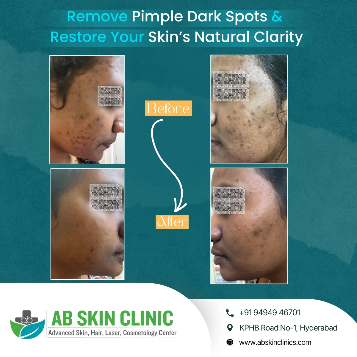 Clinic photograph published with the caption skin natural clarity.