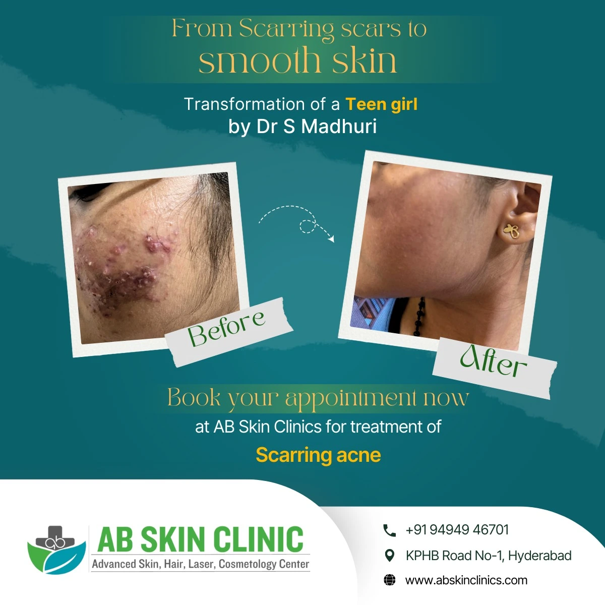 Clinic photograph published with the caption smooth skin.